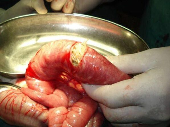than dangerous worms