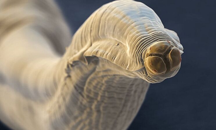 parasitic worms from the human body