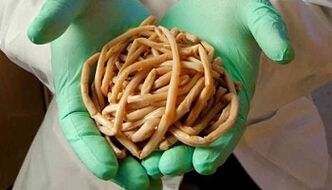 The method of removal of parasites from the body