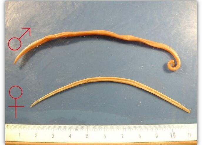The size of roundworms - worms that infect the respiratory tract of adults